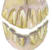 Smile (Ventral Curvature)